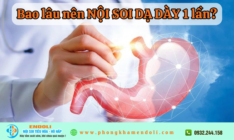 Bao lâu thì nên nội soi dạ dày 1 lần?