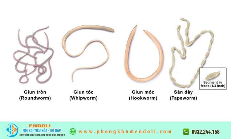 Bệnh giun sán