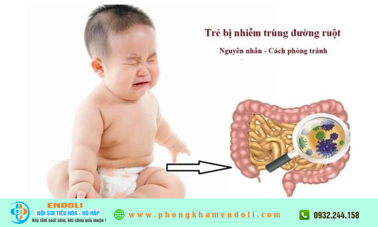 Bệnh nhiễm khuẩn - nhiễm virus đường ruột ở trẻ Em