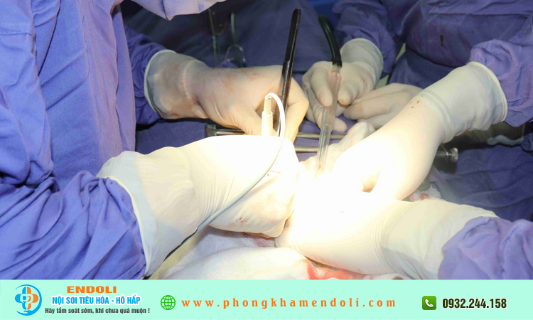Cắt ung thư dạ dày sống được bao lâu