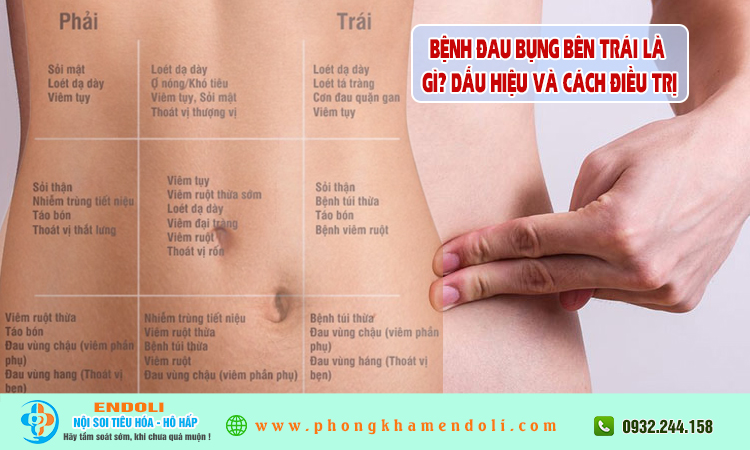 Đau bụng bên trái là bệnh gì?