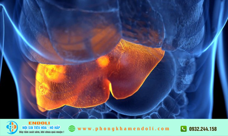 Dấu hiệu gan bị tổn thương?