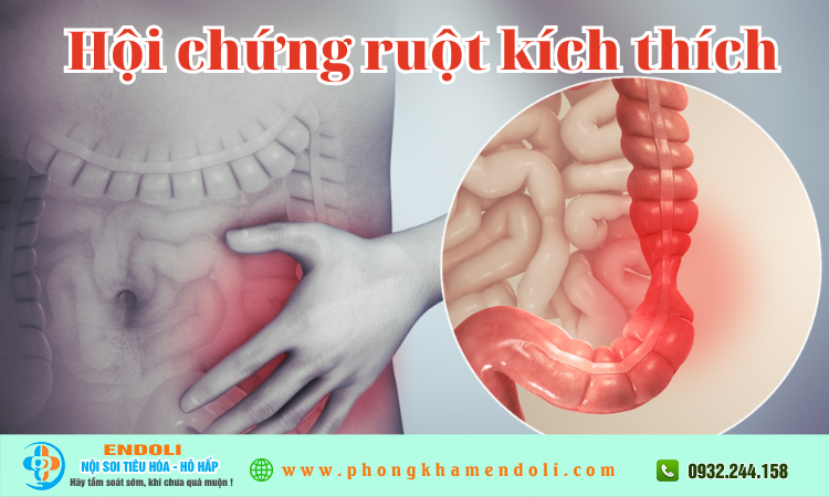 Hội chứng ruột kích thích