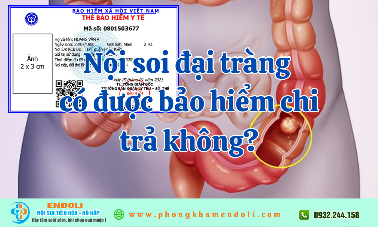 Nội soi đại tràng có được bảo hiểm chi trả không?