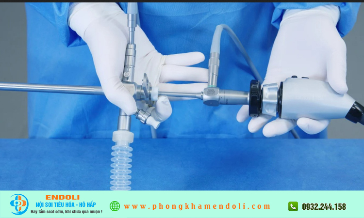 Nội soi tiêu hóa nên chọn ống mềm hay ống cứng