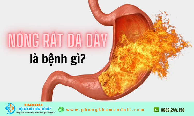 Nóng rát dạ dày