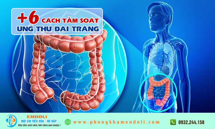 Tầm soát ung thư đại tràng