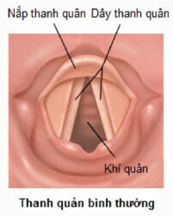 Trị khàn tiếng ở đâu
