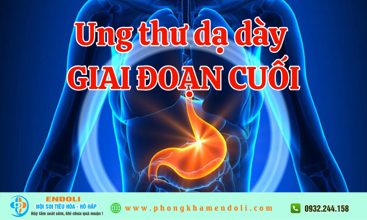 Ung thư dạ dày giai đoạn cuối