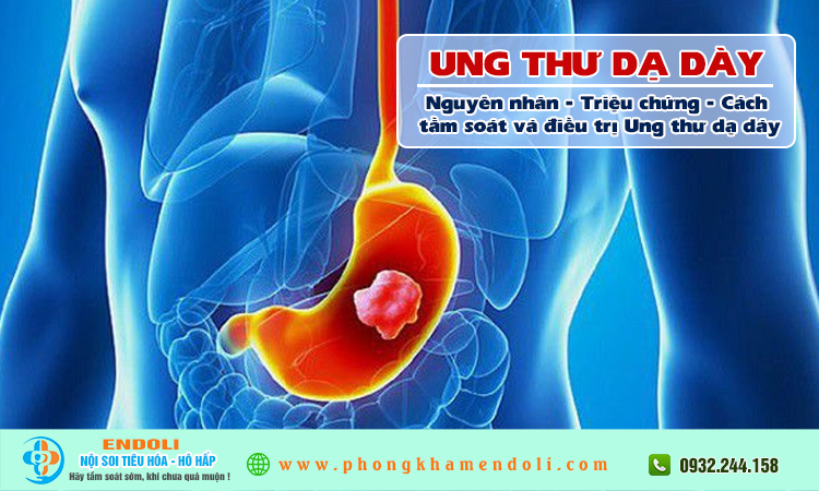 Ung thư dạ dày