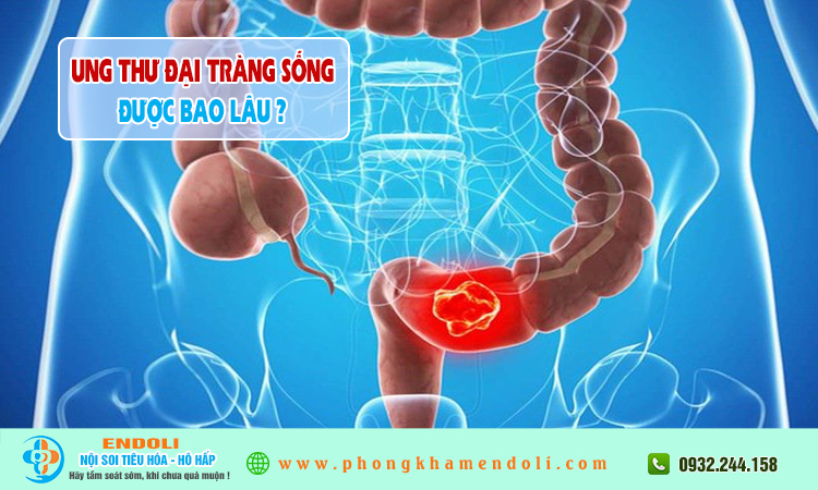 Ung thư đại tràng sống được bao lâu?