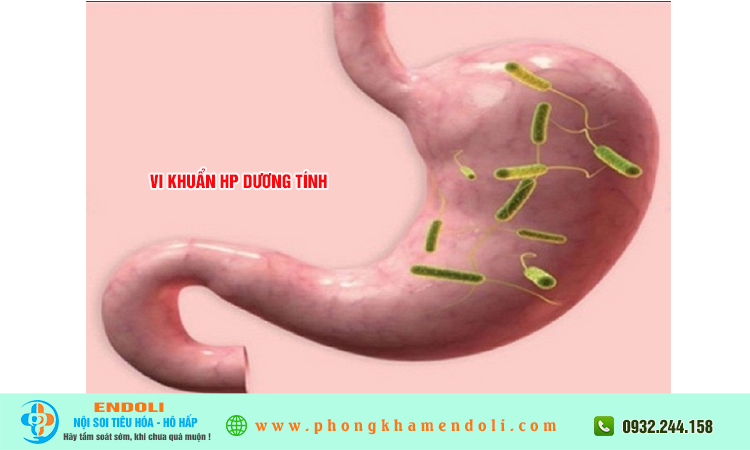 Vi khuẩn hp dương tính có nguy hiểm không?