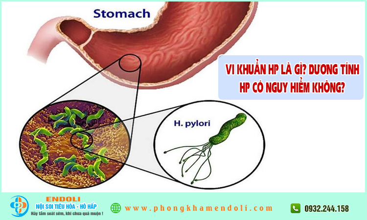 Vi khuẩn hp