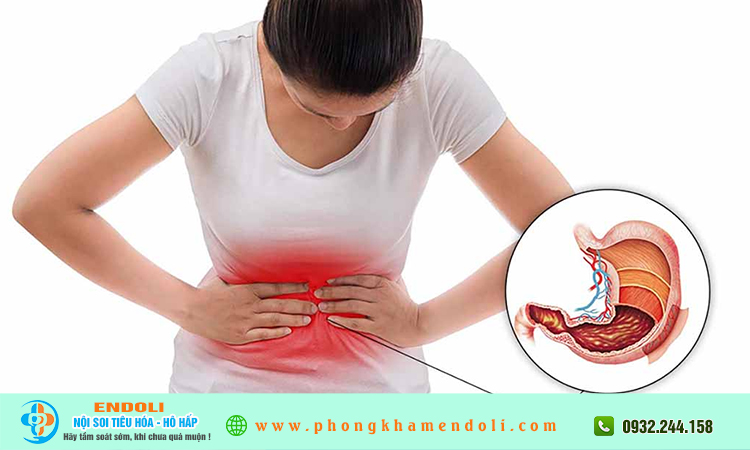 Vì sao đau dạ dày tái phát nhiều lần?