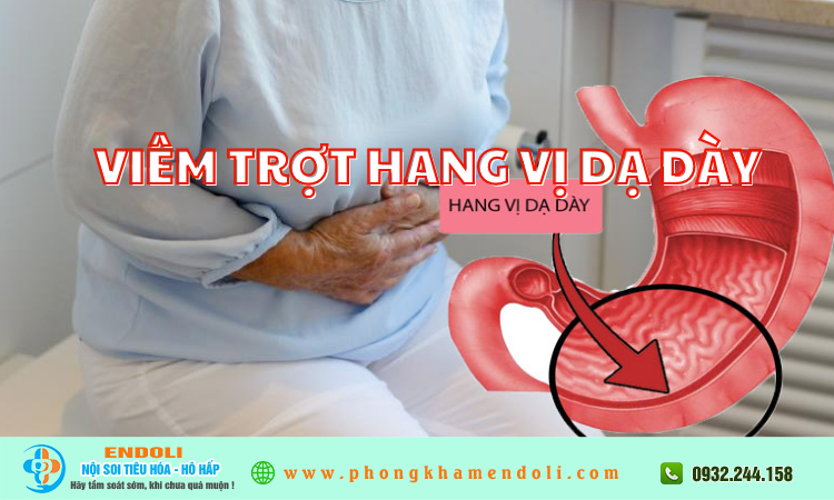 Viêm trợt hang vị dạ dày