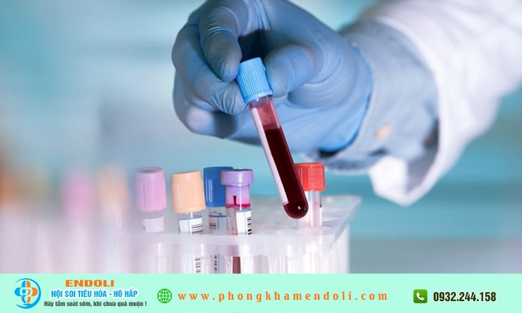 Xét nghiệm máu có phát hiện bệnh tiêu hoá không?
